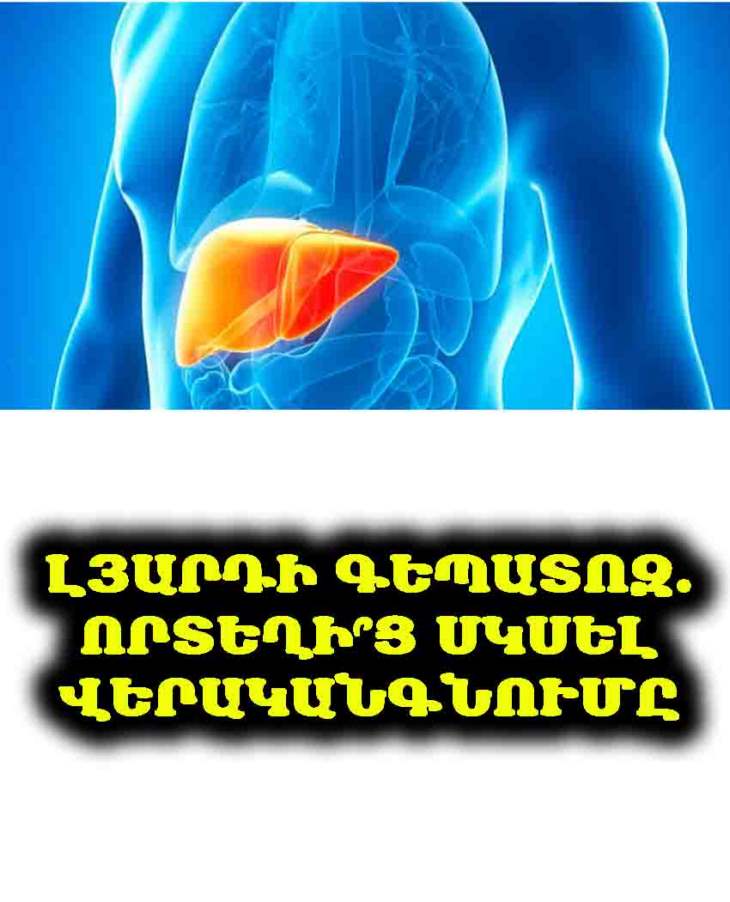 🛑 Լյարդի գեպատոզ․ որտեղի՞ց սկսել վերականգնումը