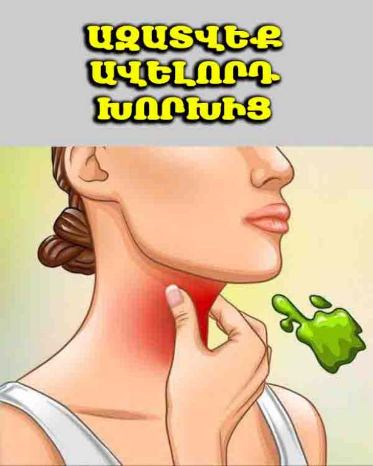 🤧 Ձեզ անհանգստացնու՞մ է խորխը. Բացահայտեք, թե ինչպես կարող եք հեշտությամբ թեթևացնել վիճակը։