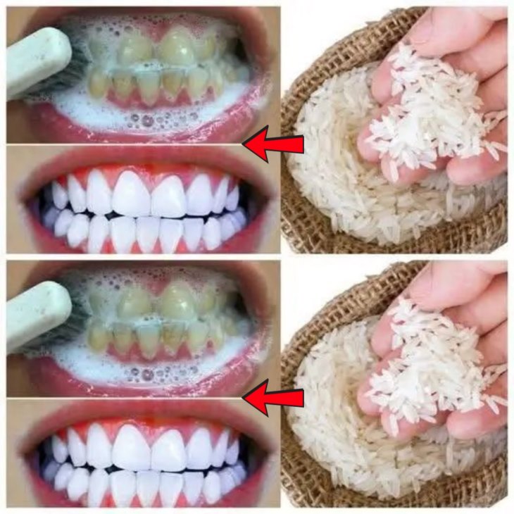 💖 Ձեր երազանքի ժպիտը. 🦷 Ատամների սպիտակեցման այս հնարքը ձեզ կզարմացնի։