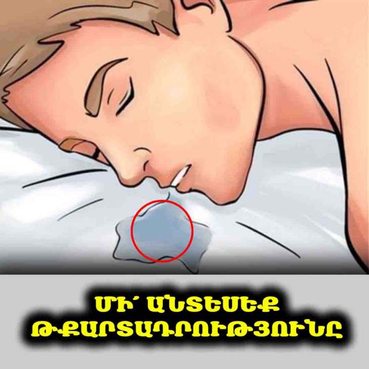 💧Քնած ժամանակ հաճախ թքարտադրություն ունեք։ Ստուգեք՝ արդյոք այս 6 հիվանդություններից որևէ մեկը չունեք