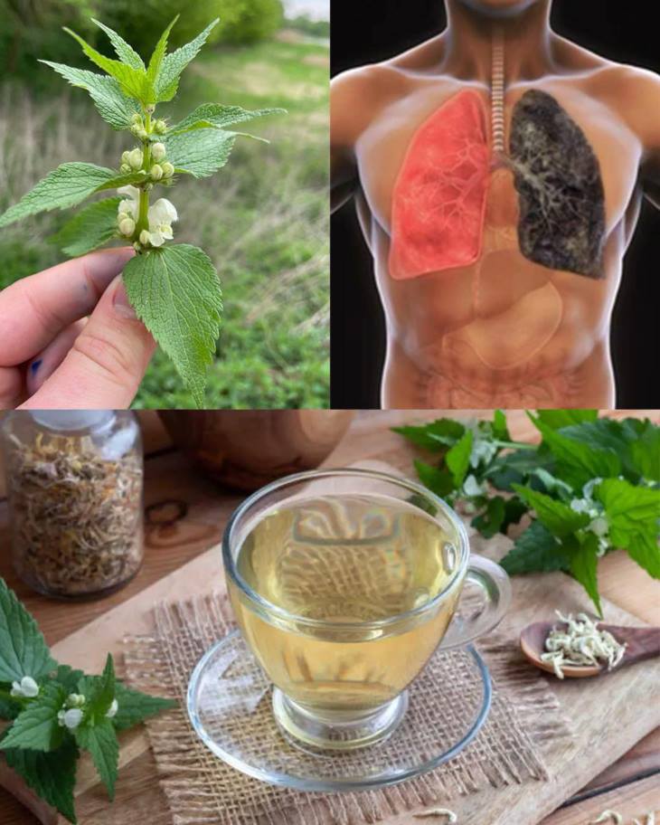 🌸 Կանացի հիվանդություններից մինչև մաշկի խնդիրներ. Սպիտակ խուլ եղինջը՝ բնական լուծում: Ի՞նչպես օգտագործել: