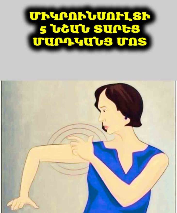 🚨 Մի՛ անտեսեք այս ախտանիշները. Միկրոինսուլտի նշաններ տարեց մարդկանց մոտ