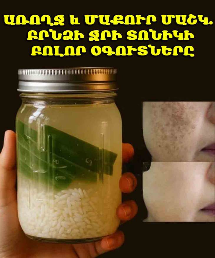 💧 Բրնձի ջուրը մաշկի համար. Ինքնաշեն տոնիկ՝ մուգ բծերը բացելու և լայնացած ծակոտիները նվազեցնելու համար
