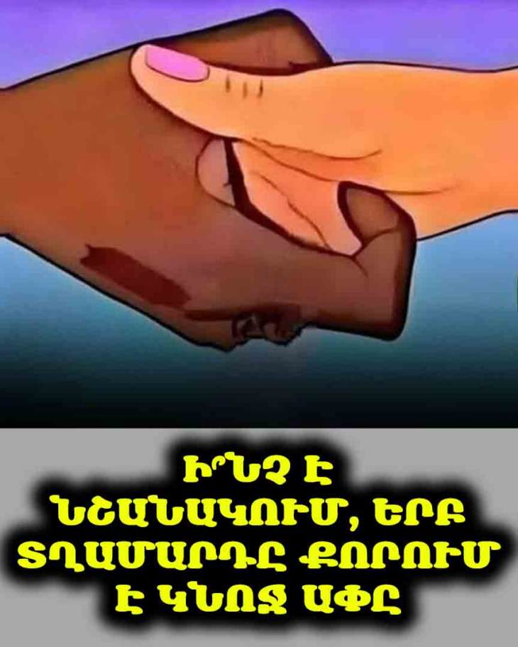 🤫 Գիտեի՞ք, թե ինչ է նշանակում, երբ տղամարդը քորում է կնոջ ափը։ Պատասխանը ձեզ կզարմացնի
