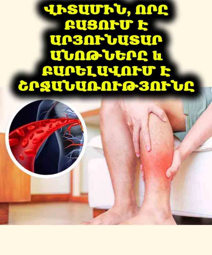 🚨 50-ն անց ե՞ք։ Սա պետք է կարդաք: Իմացեք, թե ինչպես է վիտամին B3-ը (նիացին) բացում ձեր արյունատար անոթները և բարելավում շրջանառությունը! 🦵