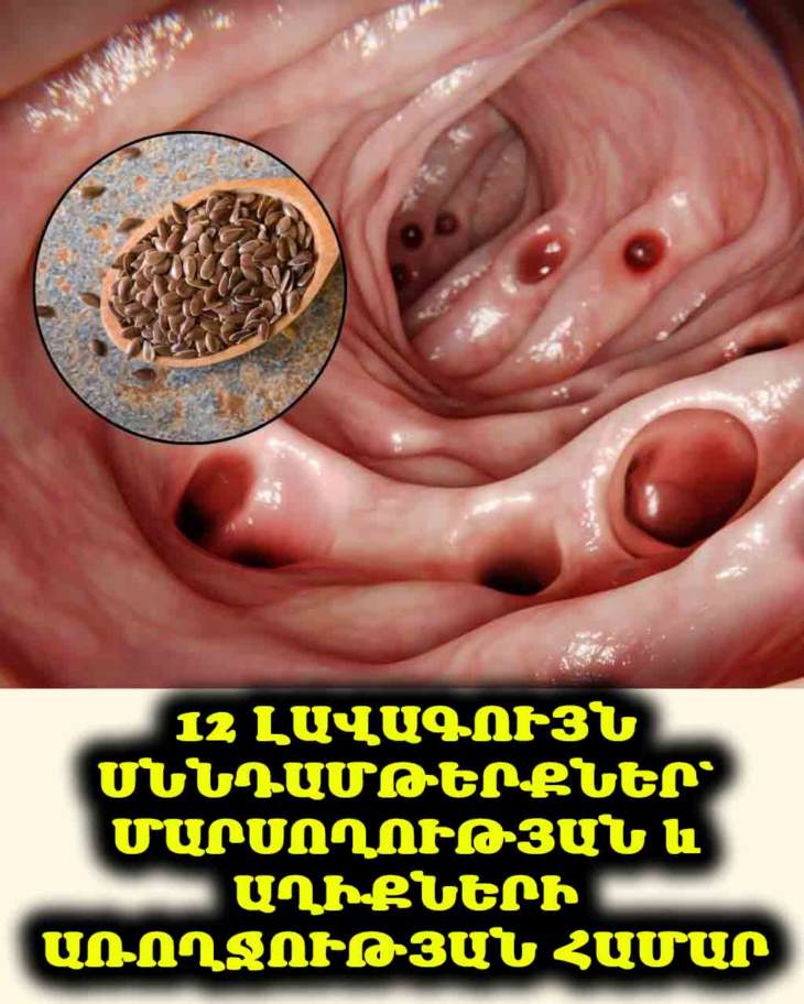 💖 Ձեր առողջությունը սկսվում է աղիքներից։ Իմացեք, թե որ 12 սննդամթերքն է ամենաօգտակարը՝ մարսողությունը բարելավելու և էներգիա ստանալու համար։
