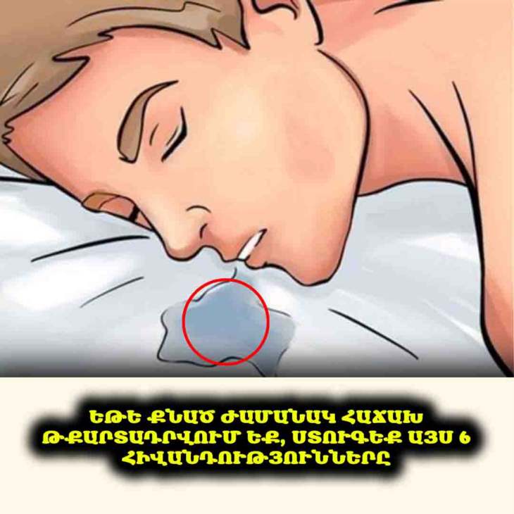 ⚠️ Մի՛ անտեսեք քնած ժամանակ թքարտադրությունը. Այն կարող է լինել լուրջ ահազանգ