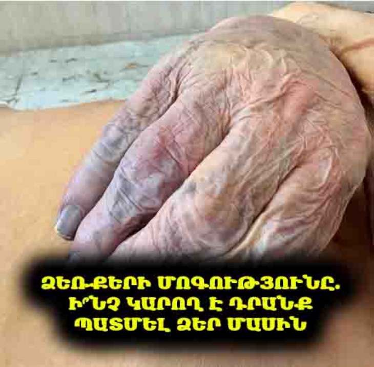 ✋ Ի՞նչ են բացահայտում ձեր ձեռքերը առաջին ժամադրության ժամանակ. Ավելին, քան կարծում եք