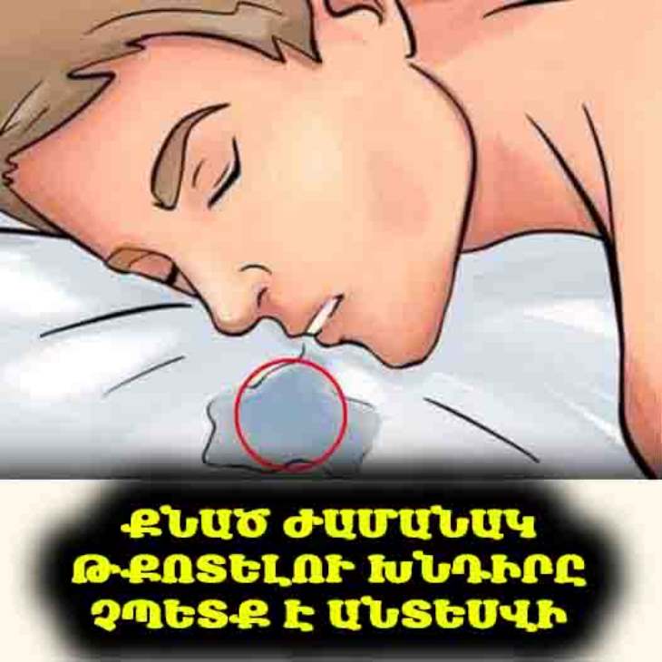 💧 Քնած ժամանակ թքոտու՞մ եք. 6 հիվանդություն, որոնք կարող են դրա պատճառը լինել։