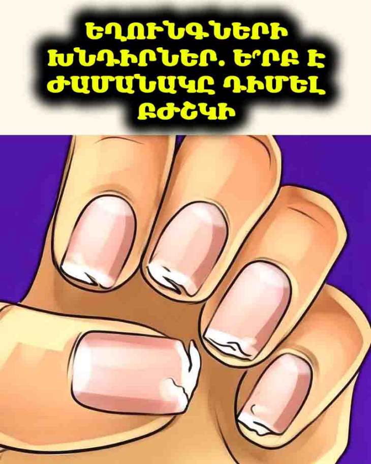 💅 Ձեր եղունգները մշտապես ճաքճքո՞ւմ են։ Սա կարևոր նշան է ձեր առողջության մասին