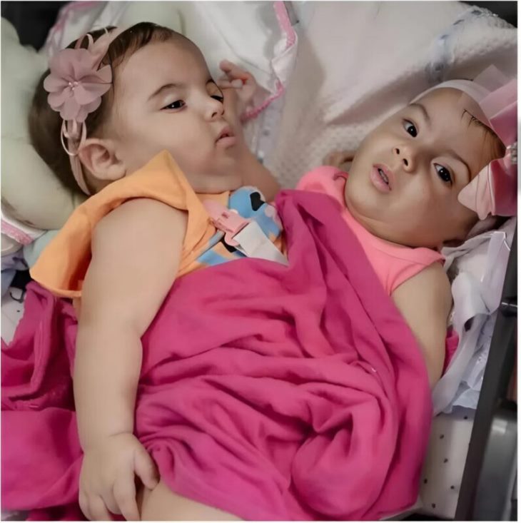 ❤️ Սերտաճած էին մեկ մարմնով, իսկ այսօր նրանք ազատ են ապրում! ✨ Այս պատմությունը կստիպի ձեզ հավատալ հրաշքներին:
