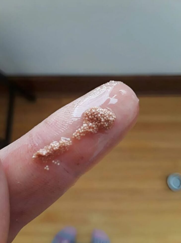 😱🥚 Հավկիթի մեջ գտա փոքրիկ, սահող գնդիկներ ու մտածեցի, թե միջատների ձվեր են, բայց հետո իմացա սարսափելի ճշմարտությունը։