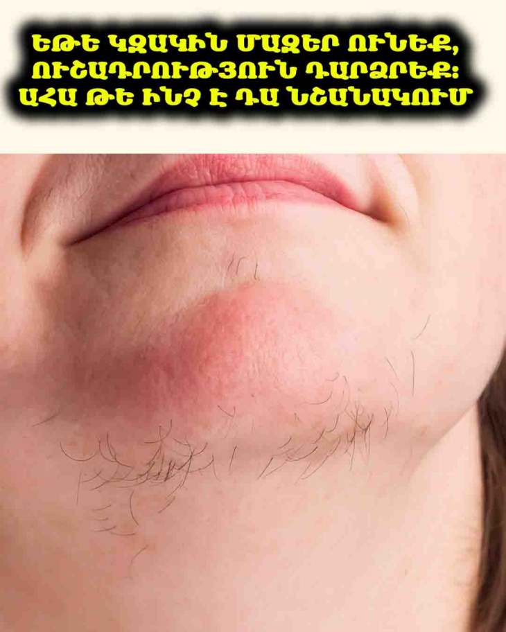 🌸 Կզակի մազերը կարող են հուշել ձեր առողջության մասին որոշ բաներ
