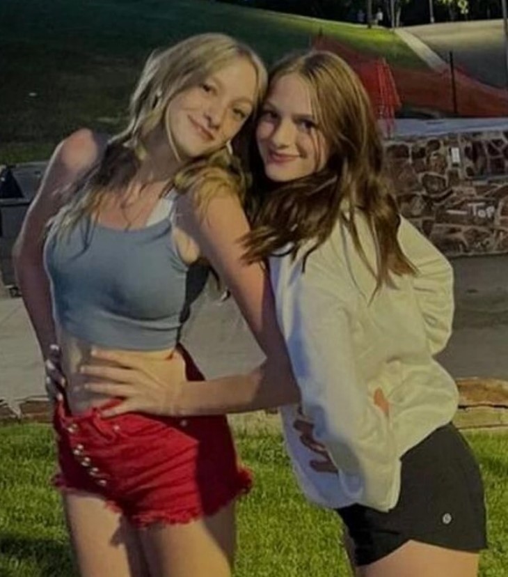 👭 Նրանց վիրահատել են վեց ամսականում։ Միացյալ երկվորյակների հուզիչ պատմությունը, ովքեր այժմ հրաշալի կյանք են վարում միասին