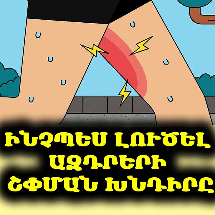 👗 Ազատվեք ազդրերի շփումից. Ամառային զգեստներ կրելու գաղտնիքը