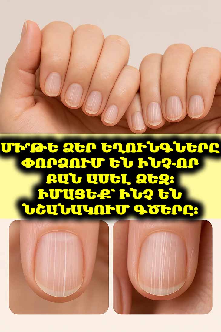 👀 Մի՞թե ձեր եղունգները փորձում են ինչ-որ բան ասել ձեզ։ Իմացեք՝ ինչ են նշանակում գծերը։