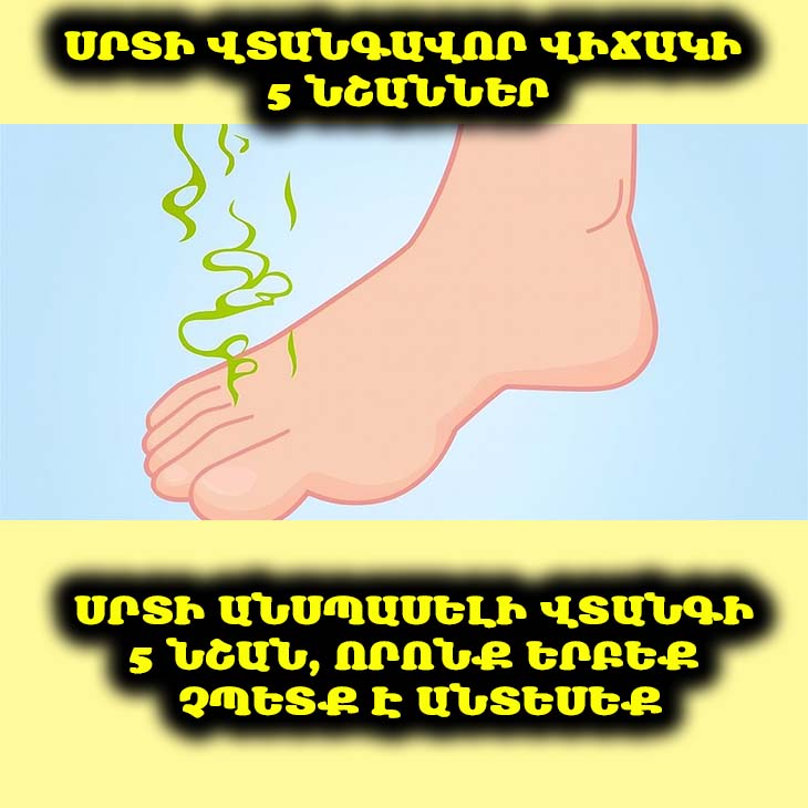 ❤️ Ձեր սիրտը ձեզ ազդանշան է ուղարկում։ Բացահայտեք այս 5 կարևոր նշանները, որոնք կարող են վկայել լուրջ խնդիրների մասին: 🩺