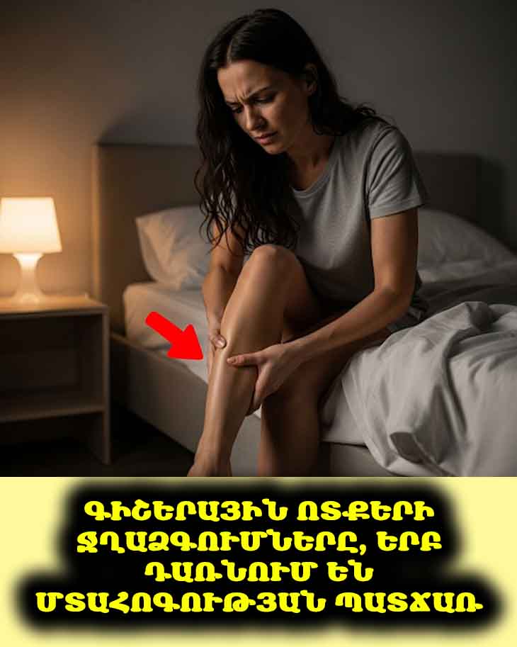 😴 Գիշերային ոտքերի ջղաձգումներ. երբ պետք է անհանգստանալ և ինչպես կանխարգելել դրանք