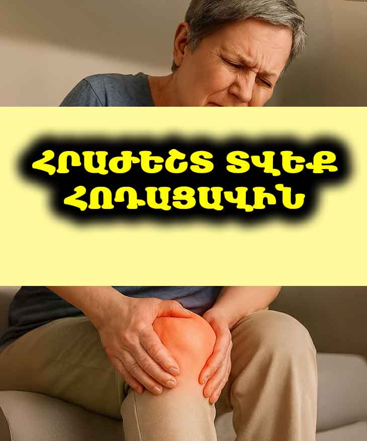 🦵 Հոդերի ցավերը ձեզ հանգիստ չե՞ն տալիս։ Փորձեք այս պարզ, բնական ըմպելիքը և զգացեք տարբերությունը։ 🌿