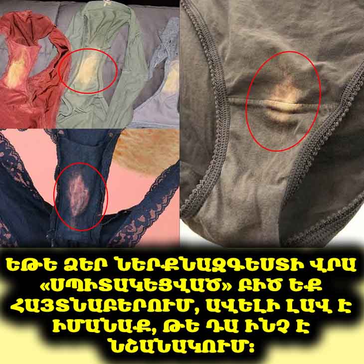 🤔 Զարմանալի հարց, որը բոլոր կանայք իրենց տալիս են. ինչո՞ւ է ներքնազգեստը երբեմն կարծես սպիտակեցված։ Պատասխանը ձեզ կզարմացնի։