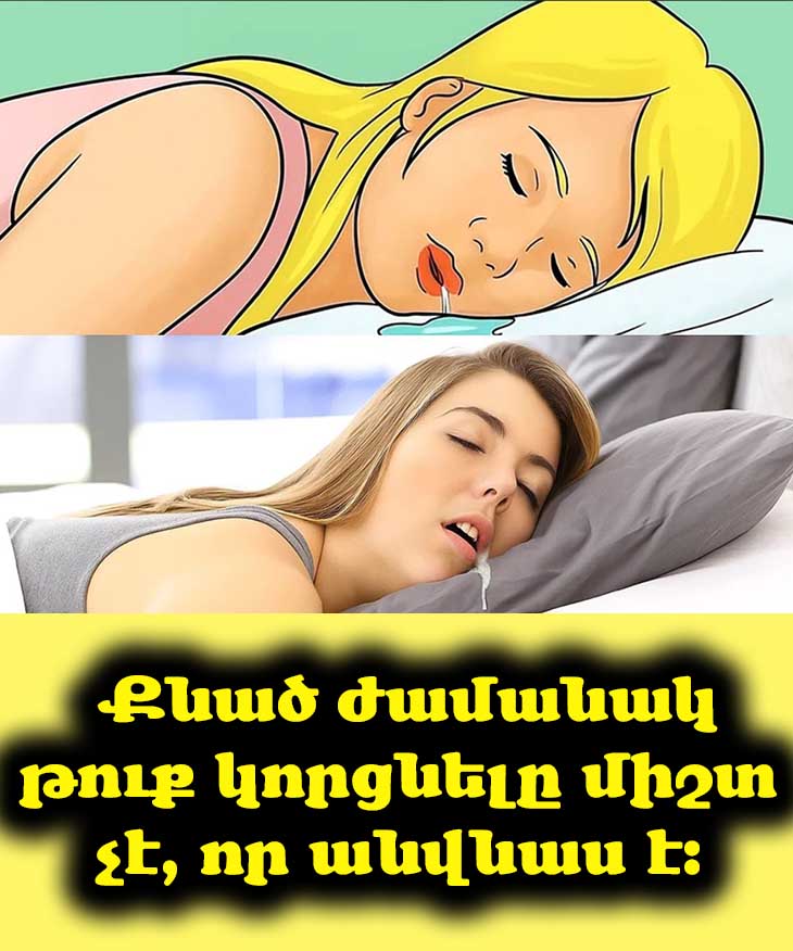 Եթե քնած ժամանակ հաճախ թուք եք կորցնում, անմիջապես ստուգեք քաղցկեղի հետ կապված այս 3 պայմանները