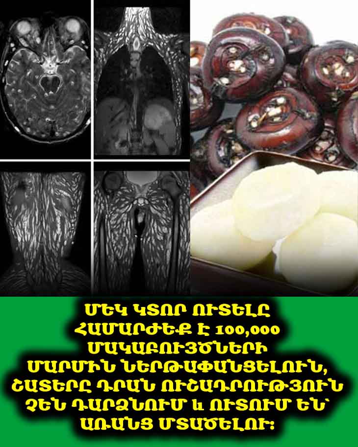 ⚠️ Դուք ուտո՞ւմ եք այս մթերքներից որևէ մեկը։ Զգույշ եղեք, դրանք կարող են մակաբույծներ պարունակել։