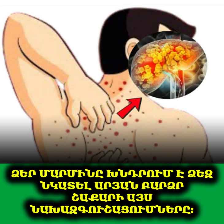 🚨 Այս ախտանշանները կարող են նշանակել, որ ձեր արյան շաքարը բարձր է։ Դրանք կարևոր է իմանալ։