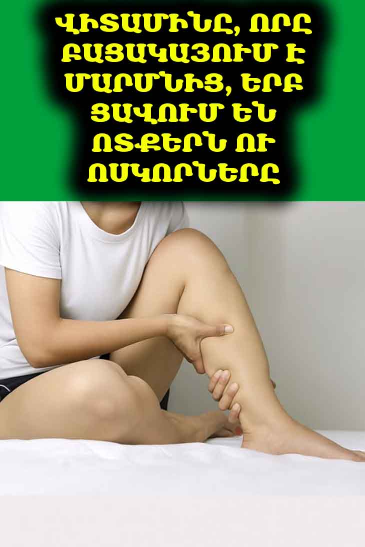 🦴 Ցավո՞ւմ են ձեր ոտքերն ու ոսկորները։ Պատճառը կարող է լինել վիտամինների պակասը։
