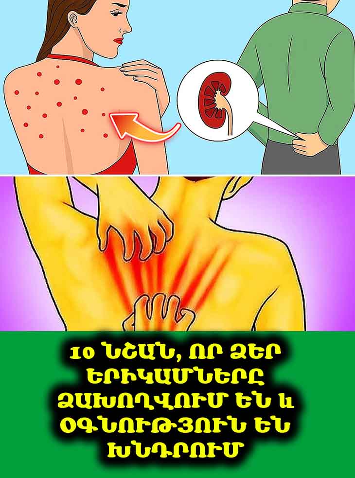 🚨 Քաղցկեղն ի սկզբանե անցավ է. այս 8 նշանները զուգարանում չպետք է անտեսել։