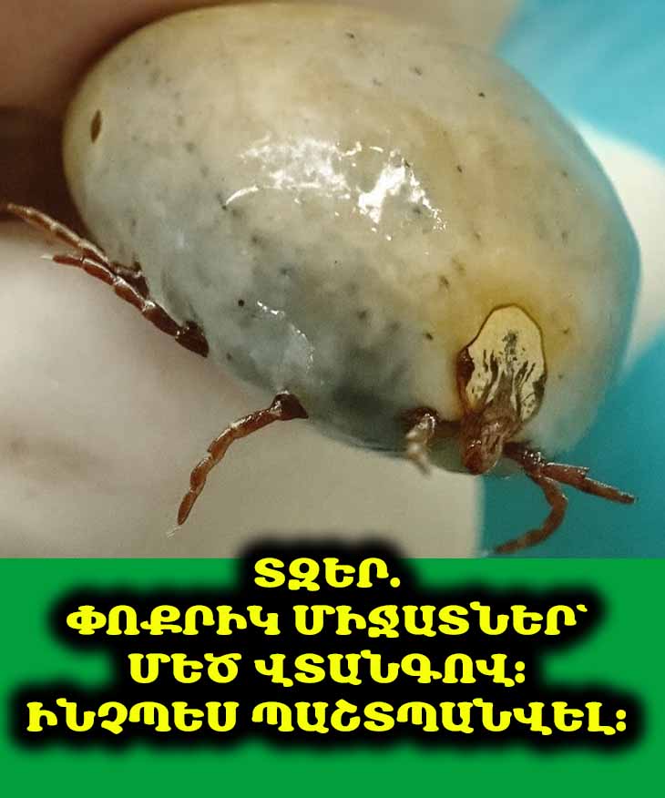 Մանրատիպ միջատներ՝ մահացու վտանգով։ Այն ամենը, ինչ պետք է իմանալ նրանց ճանաչելու, խայթոցներից խուսափելու և առողջությունը պաշտպանելու համար