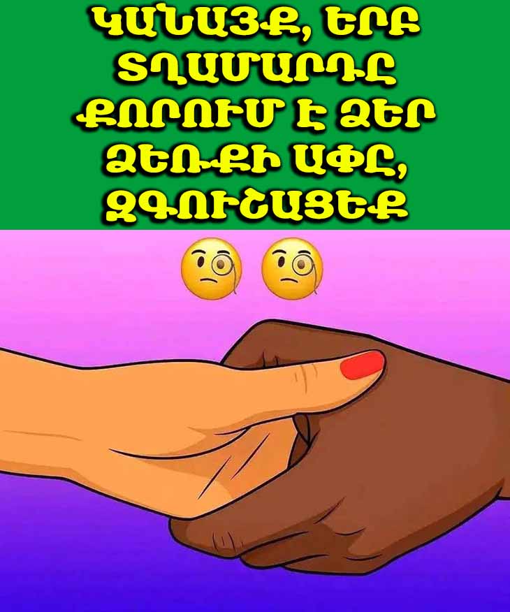 🤚 Տղամարդը քորում է ձեր ձեռքի ափը. ի՞նչ է դա նշանակում, և ինչպե՞ս արձագանքել։