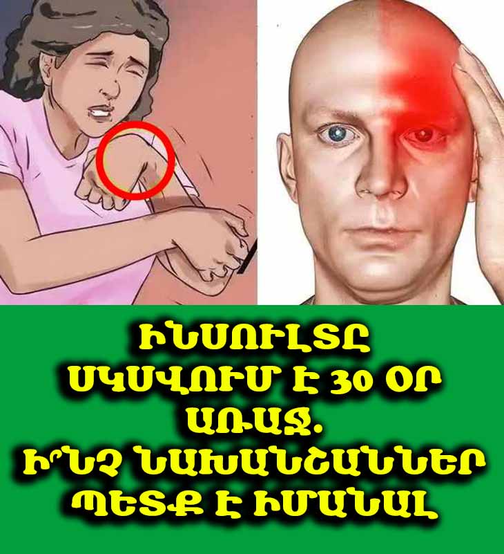 Բժիշկները զգուշացնում են՝ ինսուլտը սկսվում է 30 օր առաջ, բայց քչերն են դա հասկանում