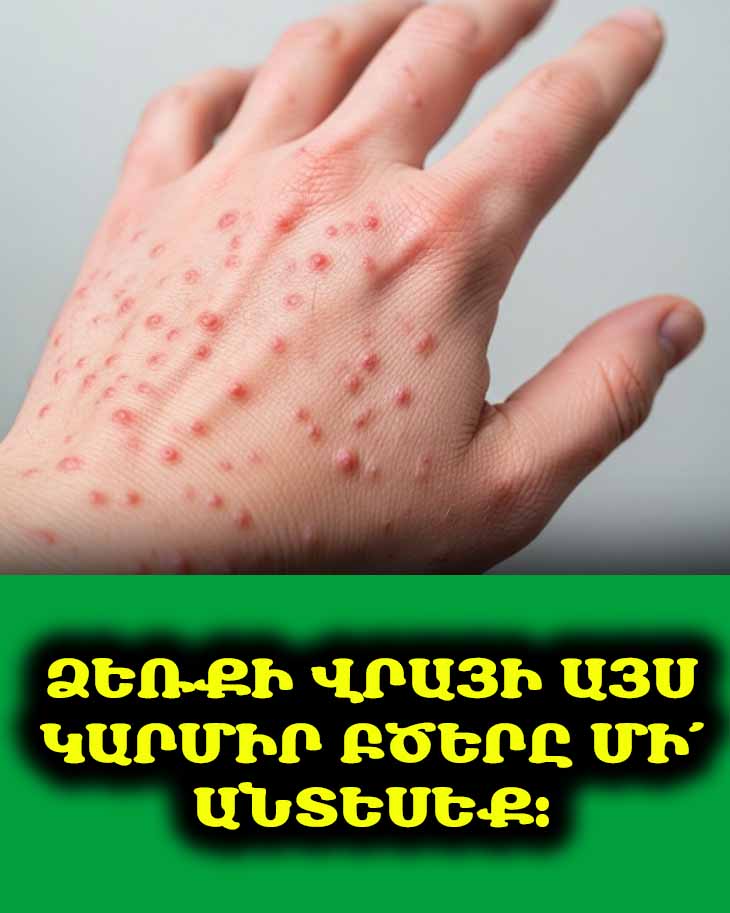 Ձեռքի վրայի այս կարմիր բծերը մի՛ անտեսեք. դրանք կարող են կարևոր նախազգուշացնող նշաններ լինել