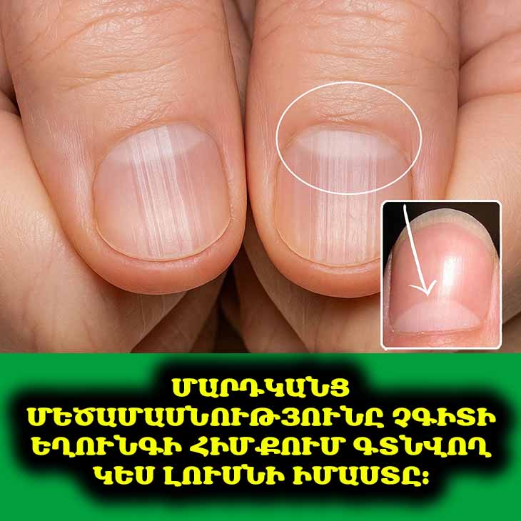 🌙 Ի՞նչ է թաքնված եղունգների հիմքի կես լուսնի տակ․ Առողջության կարևորագույն նշաններ