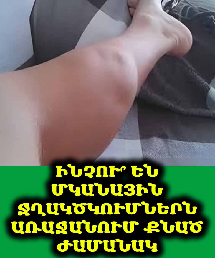 🛌 💤 Ինչու՞ են մկանային կծկումներն առաջանում քնած ժամանակ։ Իմացեք ռիսկի խմբում գտնվողների և պատճառների մասին։