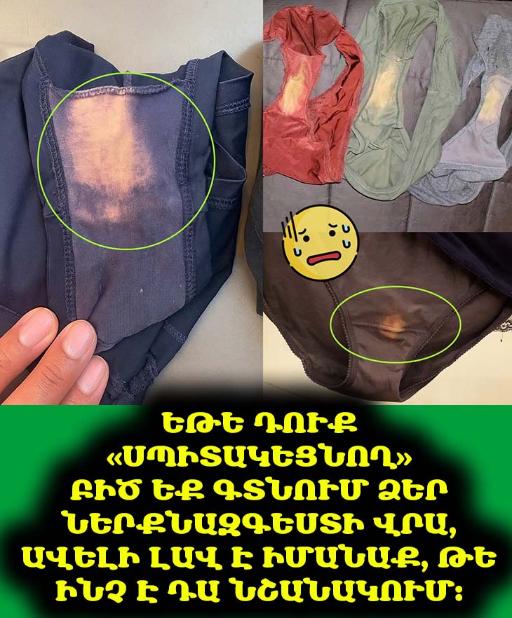 🤫 Եթե նկատել եք այս բծերը ձեր ներքնազգեստի վրա, դա լավ նշան է: Բացահայտեք պատճառը!