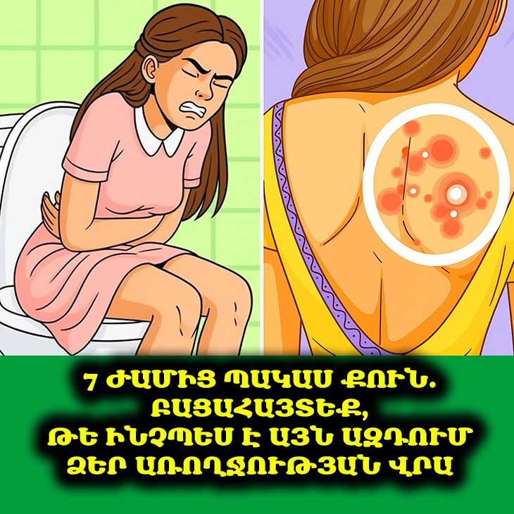 🌡️ Ինչու՞ է քունը կարևոր. Ինչպես է քնի պակասը խախտում ձեր օրգանիզմի բնական հավասարակշռությունը․ Ի՞նչ է իրականում կատարվում ձեր մարմնի հետ երբ 7 ժամից պակաս եք քնում