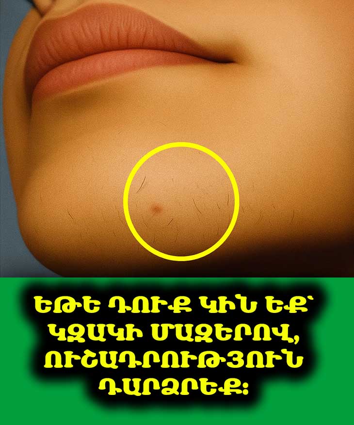 👩‍🦳 Շատ կանայք կզակի մազեր ունեն. դուք միայնակ չեք։ Բացահայտեք, թե ինչու է դա այդքան տարածված։