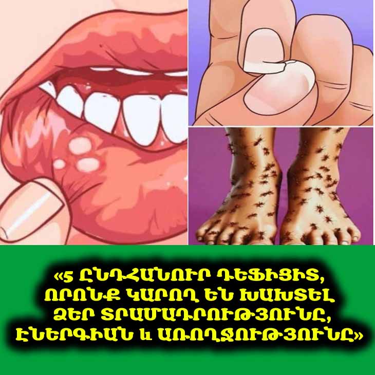 😔 Հոգնած եք զգում և տրամադրություն չունե՞ք. Պատճառը կարող է լինել ձեր սննդակարգում: