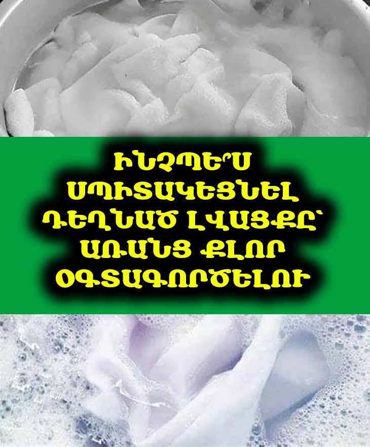 👕 Սիրելի սպիտակ շապիկը դեղնե՞լ է. Մի շտապեք դեն նետել։ Բացահայտեք հագուստը բնական եղանակով սպիտակեցնելու հեշտ և էժան միջոցը։