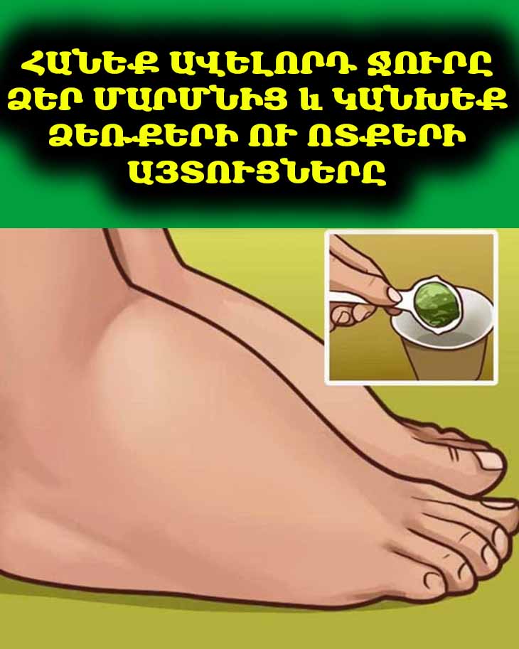 Բնական եղանակով նվազեցրեք այտուցները. բաղադրատոմսեր՝ օրգանիզմից ավելորդ ջուրը դուրս բերելու համար