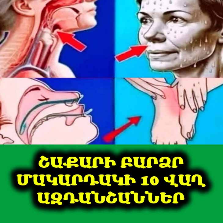 🩺 Կարո՞ղ եք իմանալ, թե արդյոք ձեր արյան շաքարը չափազանց բարձր է: Ստուգեք այս 10 վաղ ազդանշանները։