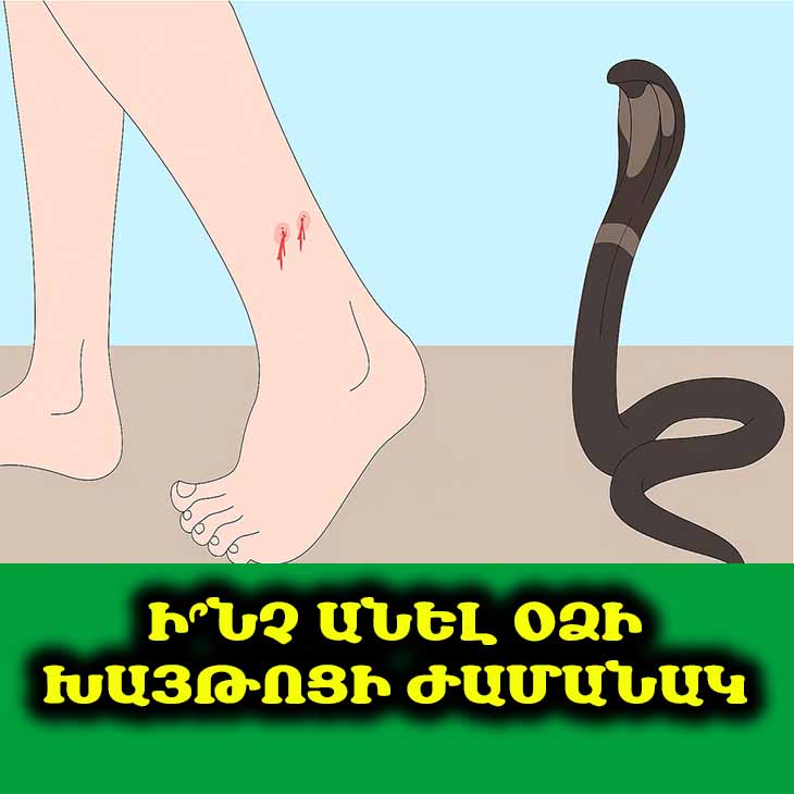 🐍 Օձի խայթոցից հետո այս սխալները կարող են ճակատագրական լինել։ Ի՞նչ անել և ինչից խուսափել։