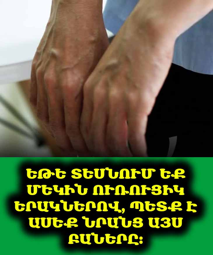 7 ամենօրյա սովորություններ, որոնք ավելի են ընդգծում ձեր երակները։ 🦵🩸