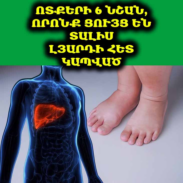 Լյարդը և ոտքերը. 6 նշան ոտքերի վրա, որոնք ցույց են տալիս լյարդի հետ կապված խնդիրներ 🦵🏼