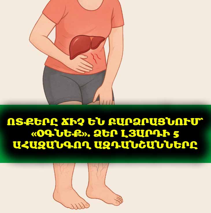 🦶 Ինչո՞ւ են ոտքերն այտուցվում և ծածկվում &laquo;աստղիկներով&raquo;։ Պատճառը կարող է լինել լյարդը։