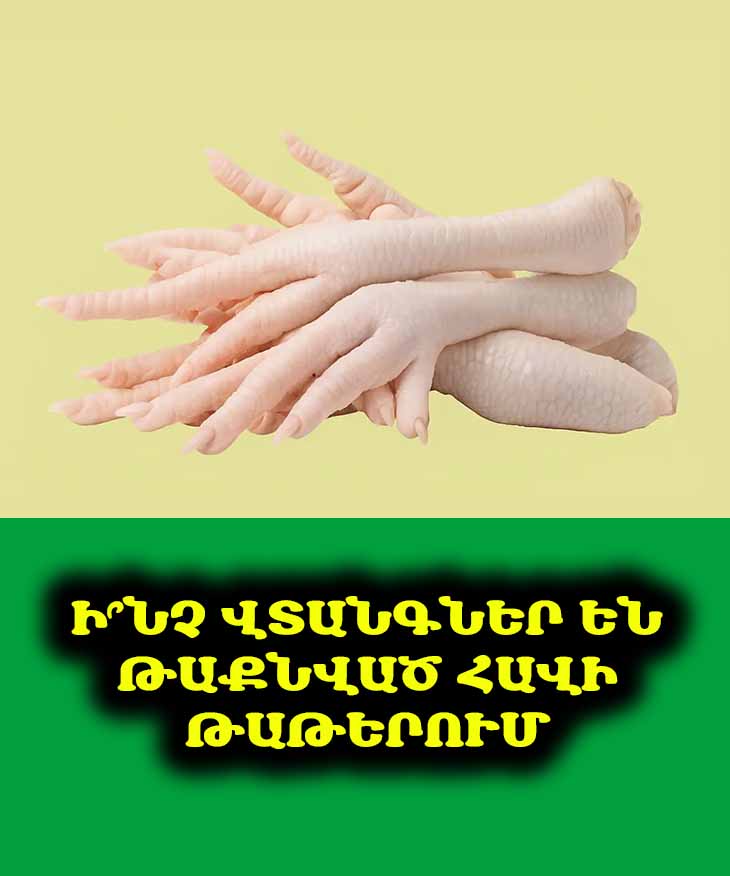 ❌ Ո՞ւմ համար են հավի թաթերը արգելված. ❌ 6 առողջական խնդիր, որոնց դեպքում պետք է խուսափել դրանցից: