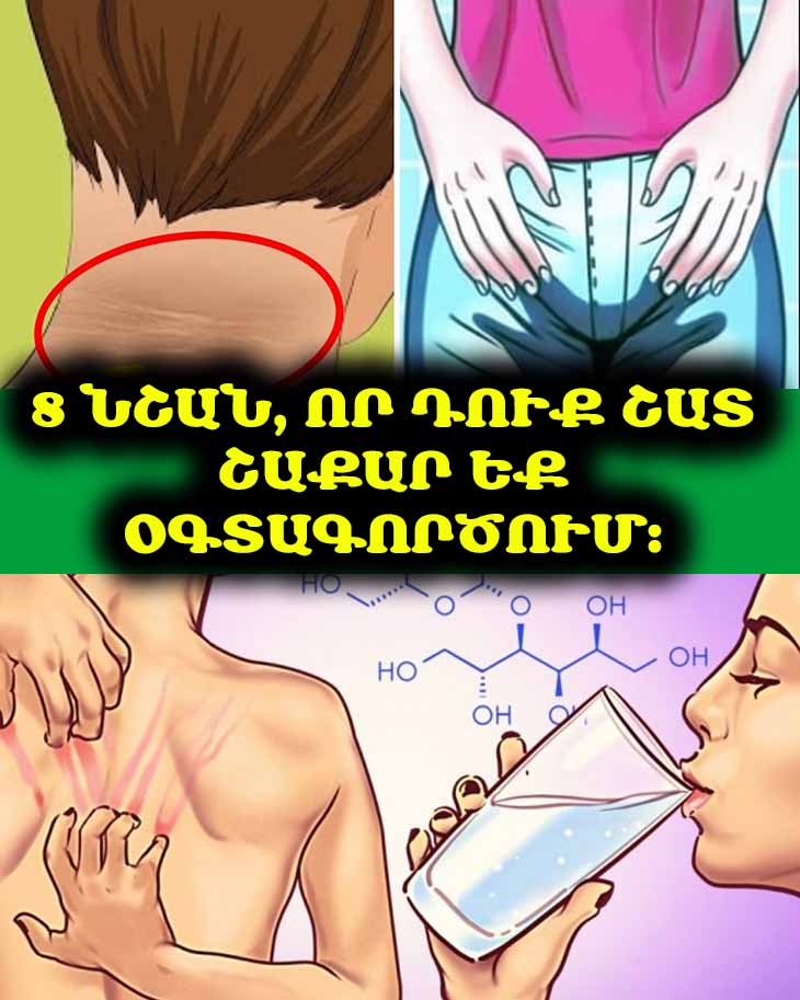 8 նշան, որ դուք շատ շաքար եք օգտագործում։