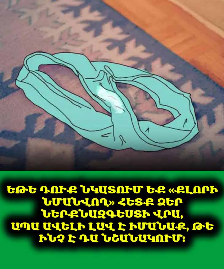 Ե՞րբ է ներքնազգեստի վրա հայտնված &laquo;քլորի նմանվող&raquo; հետքերը ազդարարում բժշկի այցելելու մասին։ 🩸