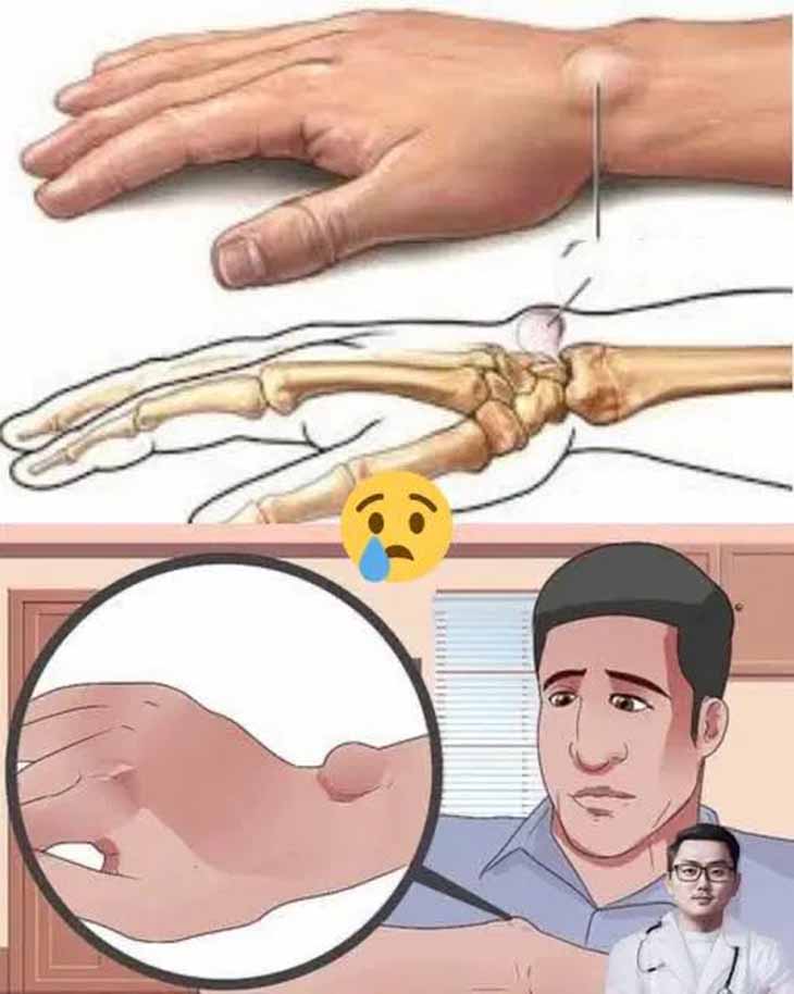 Ձեռքերի վրայի գնդիկներ. ահա թե ինչ պետք է իմանաք դրանց մասին